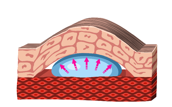 Skin during early Novoglan treatment