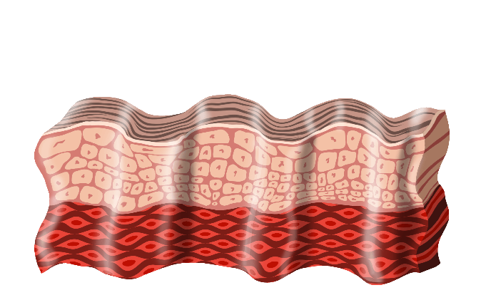 Stretched skin post treatment